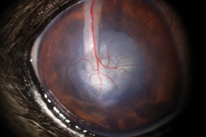 각막 천공 결막이식술 치료 후