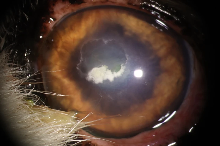 각막 궤양-각막 변성증 치료 전